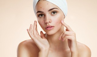 痘印黑色素沉淀怎么去除（身上痘印黑色素沉淀怎么去除）