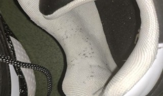 鞋子长霉斑怎么洗掉（白色鞋子长霉斑怎么洗掉）