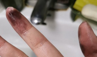 手上墨水怎么洗掉（手上墨水怎么洗掉小妙招）