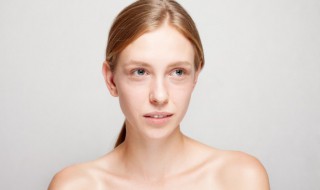 眼部细纹要怎样去 眼部细纹要怎样去掉