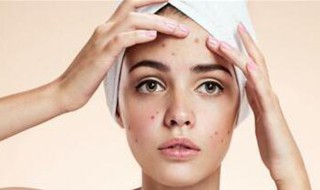 耳朵长痘痘是什么原因 经常耳朵长痘痘是什么原因