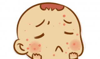 干燥怎么办(喉咙干燥怎么办)