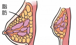 胸部脂肪多怎么减掉 胸部脂肪多怎么减掉男