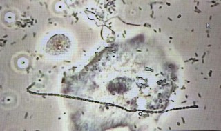 病原菌大多数属于（病原菌大多数属于什么菌）