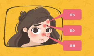 脑门上长痘痘是什么原因 头上长痘痘是什么原因