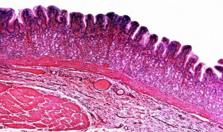 小肠粘膜上皮细胞吸收葡萄糖属于什么转运形式 小肠粘膜细胞吸收葡萄糖是主动运输吗