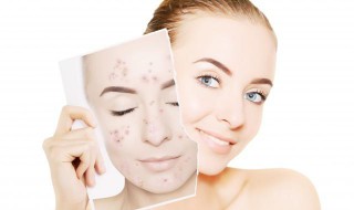 睡前怎么护肤好 晚上睡前怎样护肤