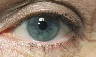 眼部皮肤问题要如何改善 眼部皮肤问题要如何改善呢