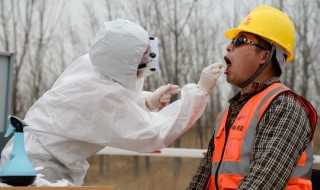 核酸检测怎么做怎么收费（做核酸检测怎么收费的）