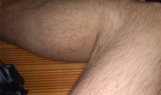 如何让腿毛消失 如何让腿毛消失并不再长