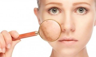 毛孔粗大的原因有哪些呢 毛孔粗大的原因有那些