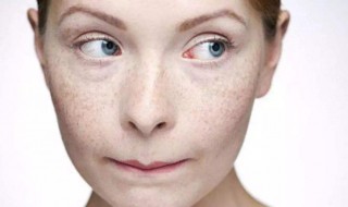去除脸上的斑小妙招（去除脸上的斑小妙招有哪些）