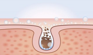 脸上有闭孔总堵塞毛孔怎么办 5个小方法帮你轻松解决