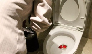 马桶除垢最好方法（除马桶污垢什么方法好）