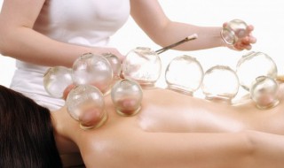 拔火罐要注意什么地方不能拔 拔火罐要注意什么地方不能拔了