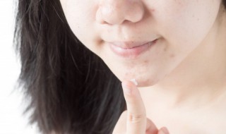 敷面膜长痘痘是怎么回事（敷面膜长痘痘是怎么回事儿）