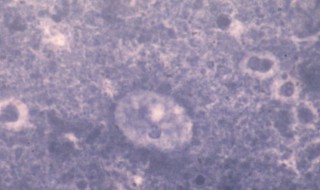 弓形虫怎么杀死 杀死弓形虫的方法