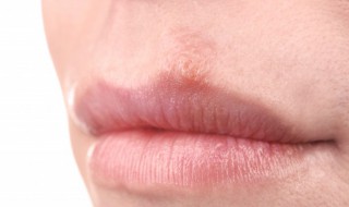 嘴唇怎么变红 嘴唇怎么变红色