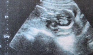 b超需要多长时间 下肢静脉b超需要多长时间