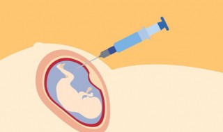 羊水穿刺是什么 羊水穿刺是什么情况下才做的