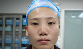 内双用窄的还是宽的双眼皮贴(内双用窄的还是宽的双眼皮贴好)