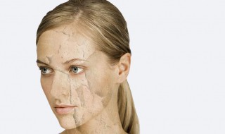 出油起皮属于什么皮肤（出油起皮属于什么皮肤疾病）