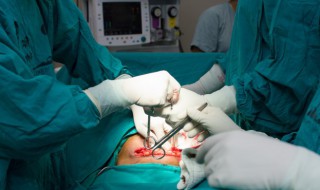 剖腹产后坐月子吃什么好 剖腹产后坐月子吃什么好恢复身体