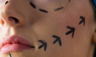 骨折病人应多吃什么 骨折病人应该多吃什么