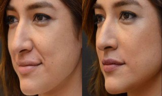 如何看法令纹深浅（法令纹怎样才算深）