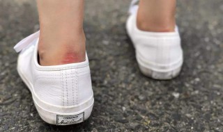 鞋底踩出方格怎么补救（鞋底方格怎么办）