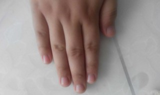 手指突然没有月牙了（手指突然没有月牙了怎么回事）
