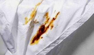 棉袄上的油渍几年了怎么去除 棉袄上的油渍几年了怎么去除掉