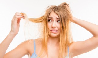 处理头皮屑的技巧 处理头皮屑的技巧和方法