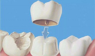 洗牙粉怎么用（洗牙粉怎么用才正确）