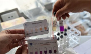 火碱吃了一点点怎么办（火碱吃了一点点怎么办没事吧）