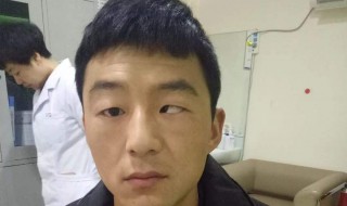 如何判断斜视(斜视如何判断)