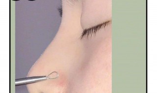 祛完黑头后怎么处理（祛完黑头后怎么处理掉）