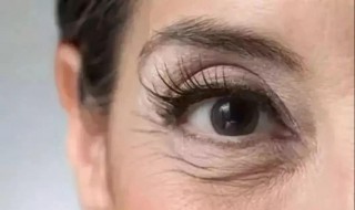 有了眼纹眼袋怎么办 有眼纹眼袋怎么消除