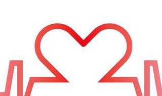 什么是阵发性室上性心动过速（什么叫阵发性室上性心动过速）