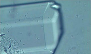 尿酸盐什么意思（尿酸盐主要成分）