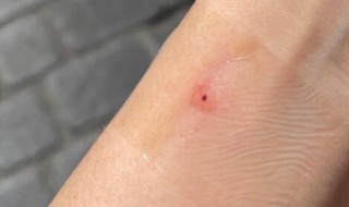 朱砂痣什么样 什么叫朱砂痣