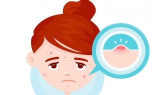 闭合性粉刺是什么原因引起的 额头闭合性粉刺是什么原因引起的