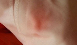 白衣服被染色怎么洗掉 白衣服被染色怎么洗掉小妙招