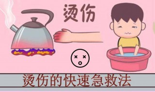 开水烫伤处理小妙招（开水烫伤怎么治疗最见效）