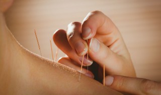 针灸的作用和功效（女人针灸的作用和功效）