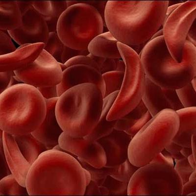 红细胞平均体积偏高的原因有哪些