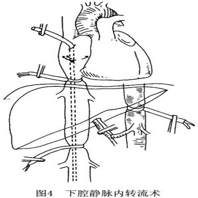 失血性贫血怎么回事以及处理？