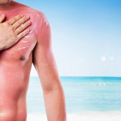 尿很黄怎么回事