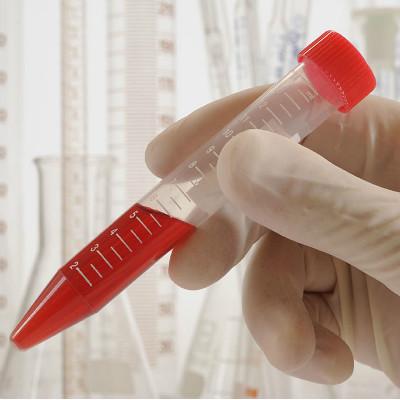 做血常规检查需要空腹吗?