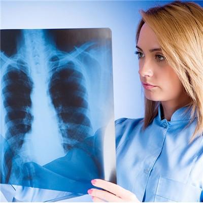 体检说红细胞计数偏高是什么原因啊?